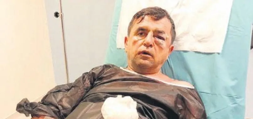 50 milyon dolarlık kumpas! Öldüresiye dayak...