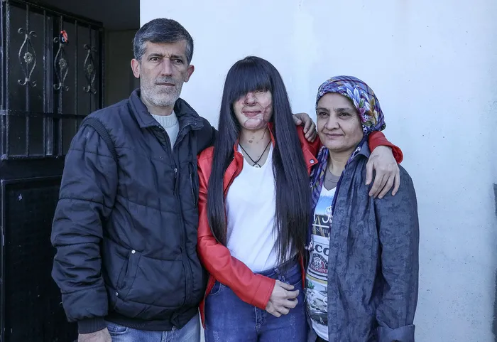 Asitli saldırı mağduru Berfin Özek ve ailesinden Başkan Erdoğan’a teşekkür