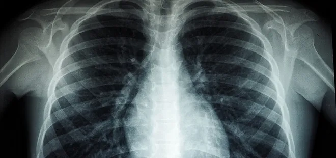 Nasıl olsa geçer demeyin! Bu belirtiler kanserin habercisi olabilir