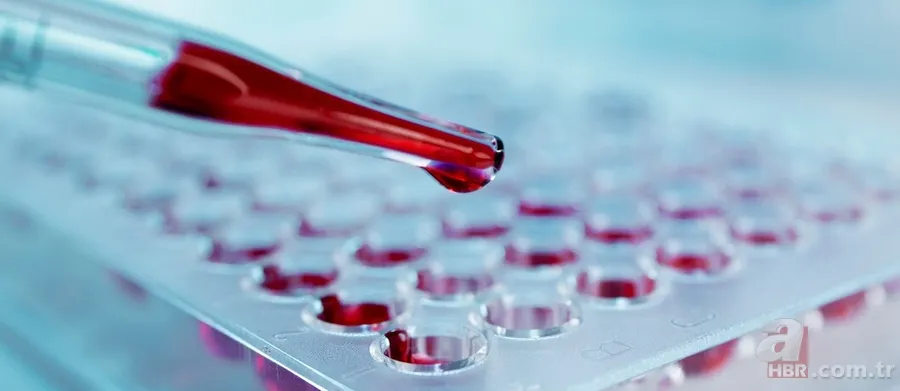 Bu kan grubuna sahip olanların zekası fişek gibi çıkıyor: A Rh (+), 0 Rh (-), AB, B, 0... 7