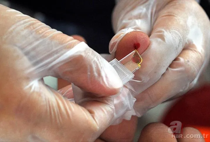 Kan grubuna göre beslenme nedir? Kan grubu 0, A, B , AB olanlar bu besinleri tüketin! 2