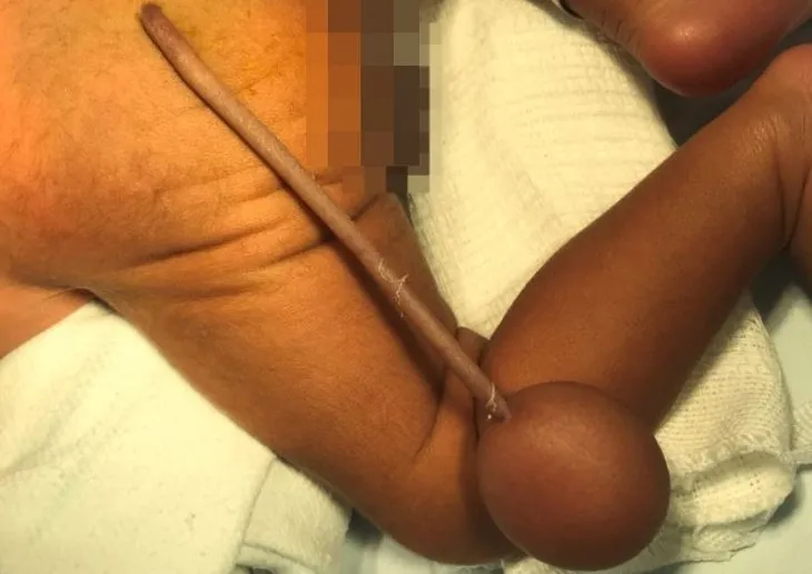 Bilim dünyasını şaşırtan ve heyecanlandıran olay! 12 santimetre kuyrukla doğdu