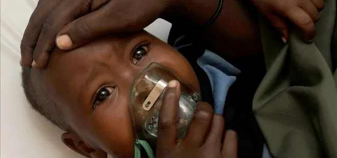 Nijerya’da Lassa ateşi salgını: 127 ölü