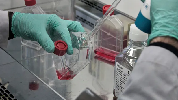 Dizanteri nedir, nasıl bulaşır? Belirtileri neler? Mide ağrısı, ishal, ateş...Tedavisi, aşısı var mı? Amipli/Basilli dizanteri