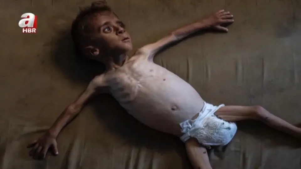 İsrail açlığı silah olarak kullanıyor!