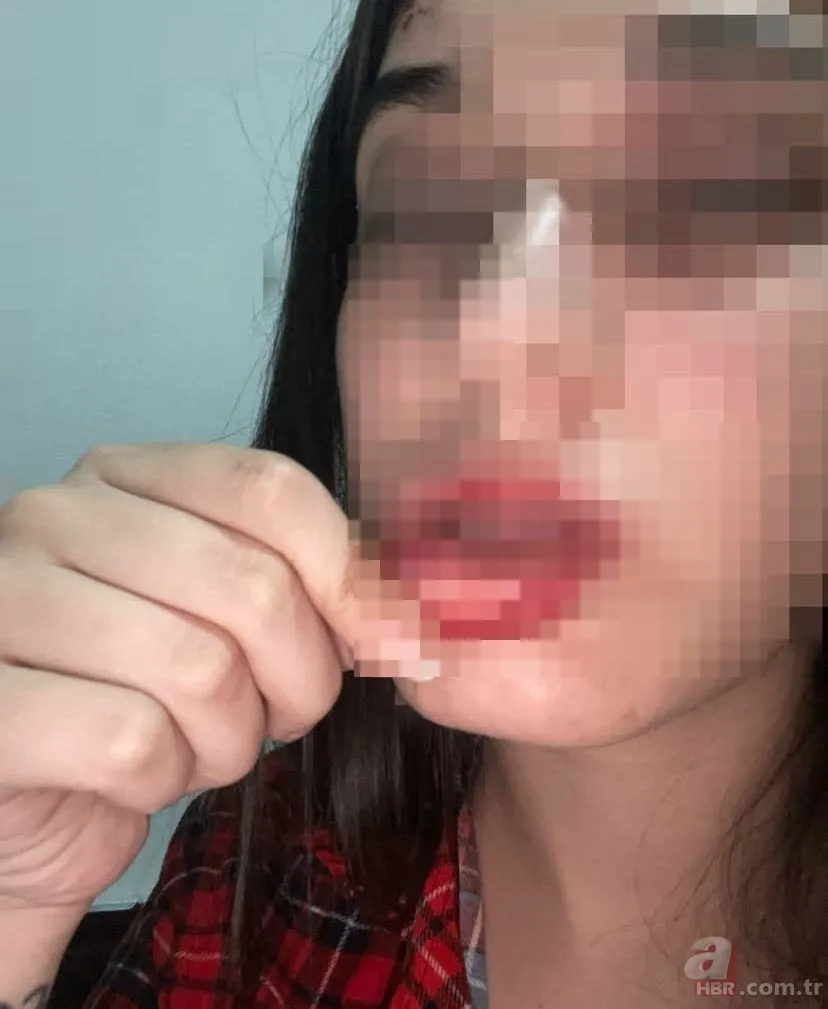 “Konuşacağız” deyip tuzak kurdu: Genç kadın dehşeti yaşadı 4