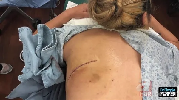 30 yıl boyunca baş ağrısıyla yaşadı! Nedeni şoke etti... 140