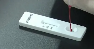 Ödüllü test kiti büyük kolaylık sağlayacak! Artık evlerde tespit edilebilecek