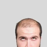 Saçı dökülenlere mucizevi çözüm