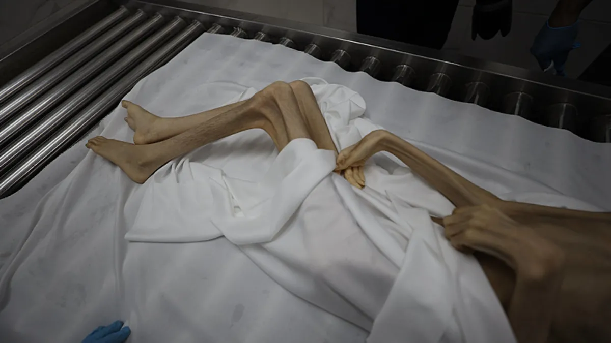 Gazze açlıktan ölüyor! 11 Filistinli daha açlıktan can verdi