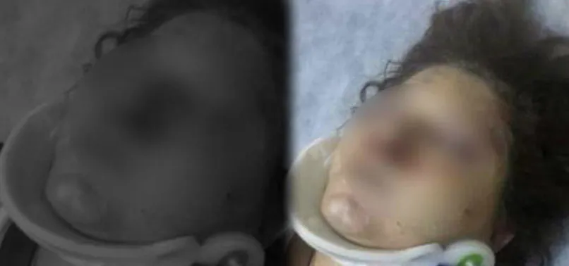 Çığlıkları duyan komşuları yardıma yetişti