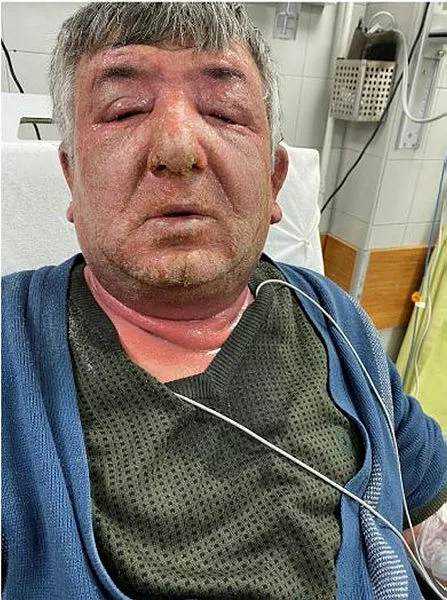 Taksici müşterinin koronavirüs olmasında şüphelenip yüzüne 3 gün boyunca dezenfektan sürünce hastanelik oldu - 7