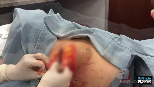 30 yıl boyunca baş ağrısıyla yaşadı! Nedeni şoke etti... 126