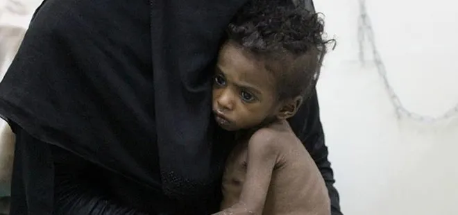 UNICEF’ten Yemen’deki çocuklar hakkında açıklama