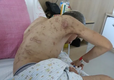 Ankara'da facia! 12 yaşındaki çocuk 10 köpeğin saldırısına uğradı