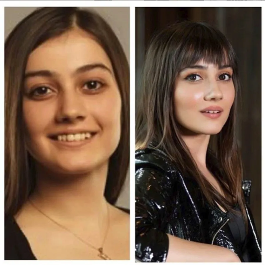 uyanis buyuk selcuklu turna hatun u sevda erginci nin eski hali soke etti estetiksiz goren taniyamadi