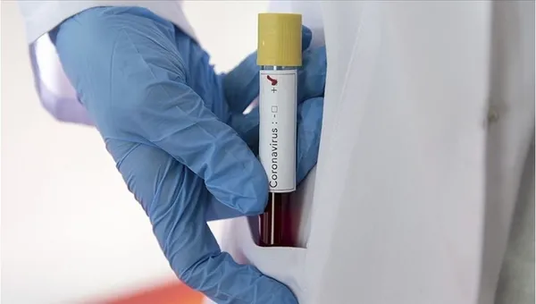 Son dakika:Dünya genelinde koronadan en çok can kaybının yaşandığı 20 ülke!