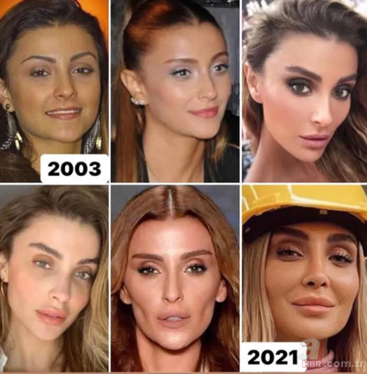 Ebru Yaşar’dan estetik itirafı: Kimse yüzüme bakmazdı 25