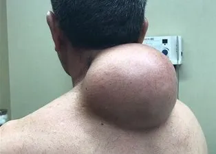 Boynu bu haldeydi! Acil ameliyata alındı...