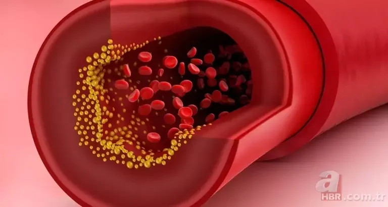 Türklerin beyaz altını: Tıkanan damarları açıyor! LDL kolesterolü hızlıca düşüren tek besin... 4