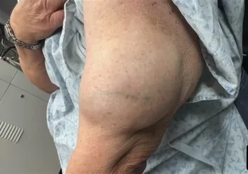 Kolundan çıkanı gören şoke oldu!