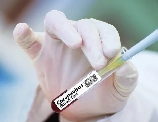 son-dakika-koronavirus-asisinin-piyasaya-surulmesini-yasakladilar-dunyanin-en-buyuk-asi-ureticisi-firmaya-sok-1609696277881.jpg Son dakika: Koronavirüs aşısının piyasaya sürülmesini yasakladılar! Dünyanın en büyük aşı üreticisi firmaya şok - 4