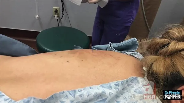 30 yıl boyunca baş ağrısıyla yaşadı! Nedeni şoke etti... 137