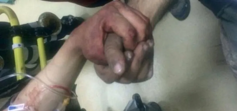 Yaralı kahraman Mehmetçikler göz yaşarttı!