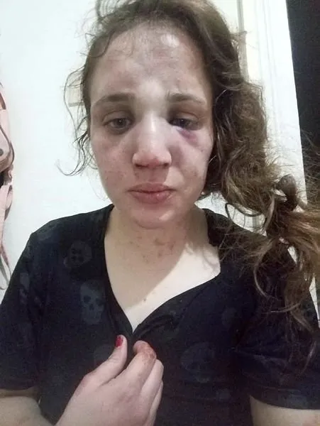 Aydın'da işkenceci koca 3 çocuğunun annesini bu hale getirdi - 1