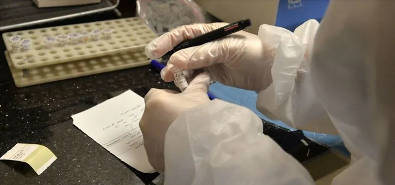 Son dakika: İran Devrim Muhafızları komutanlarından Şabani koronavirüs nedeniyle hayatını kaybetti