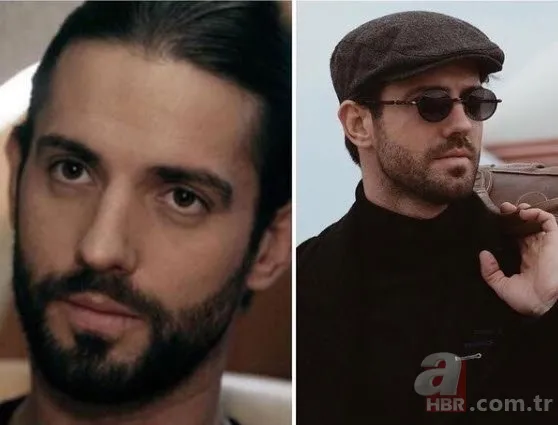 Pınar Dilşeker görenleri şoke etti! Yaptırdığı estetiklerle öyle bir hale geldi ki tanımak imkansız 19