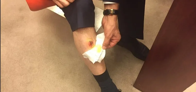 AK Parti milletvekili Muhammet Balta'nın bacağını kim ısırdı?