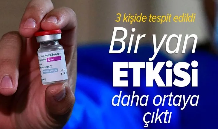 AstraZeneca aşısının bir yan etkisi daha ortaya çıktı!