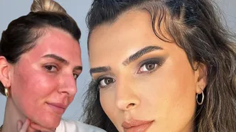 Güzellik uğruna yüzünü yaktırdı! Merve Aydın’ın son hali şaşırttı