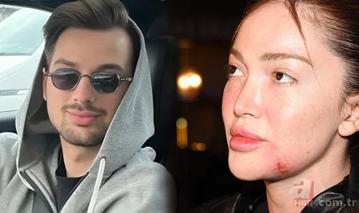 Danla Bilic'i ölümle tehdit etti! Berk Çetin eski sevgilisinin peşini bırakmıyor 1