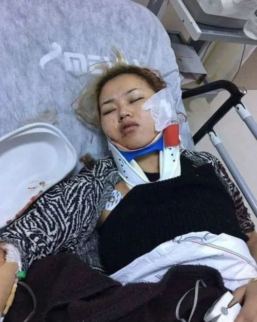 antalyada-fuhsa-zorlanan-kirgiz-kiz-5-sene-sonra-ortaya-cikti-talihsiz-kizin-yasadiklari-kan-dondurdu-1641809024559.jpg Antalya’da fuhşa zorlanan Kırgız kız 5 sene sonra ortaya çıktı! Talihsiz kızın yaşadıkları kan dondurdu - 4