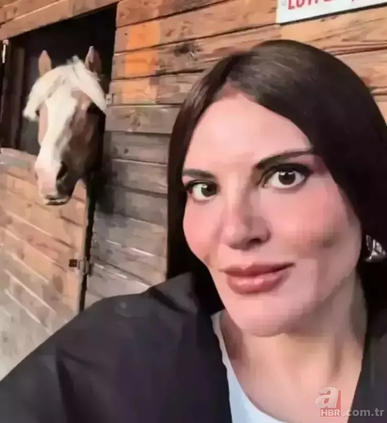 Göksel'den estetik açıklaması! "O kişiyi tanımıyorum" 5