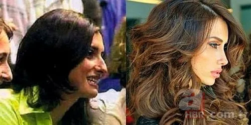 Miray Daner'e ne oldu? Yüzündeki değişim şaşırttı 18