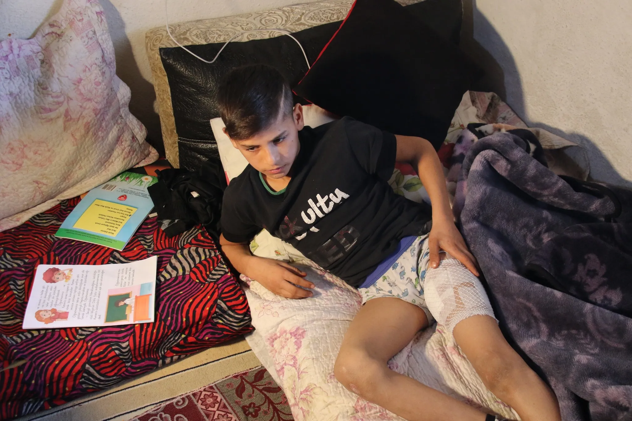 Ankara’da köpeklerin saldırdığı minik Ramazan yaşadıklarını anlattı: Bacağımdan etimi kopardılar