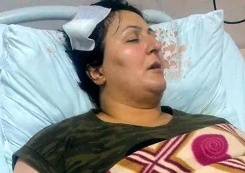 Komşusu beyzbol sopasıyla bu hale getirdi