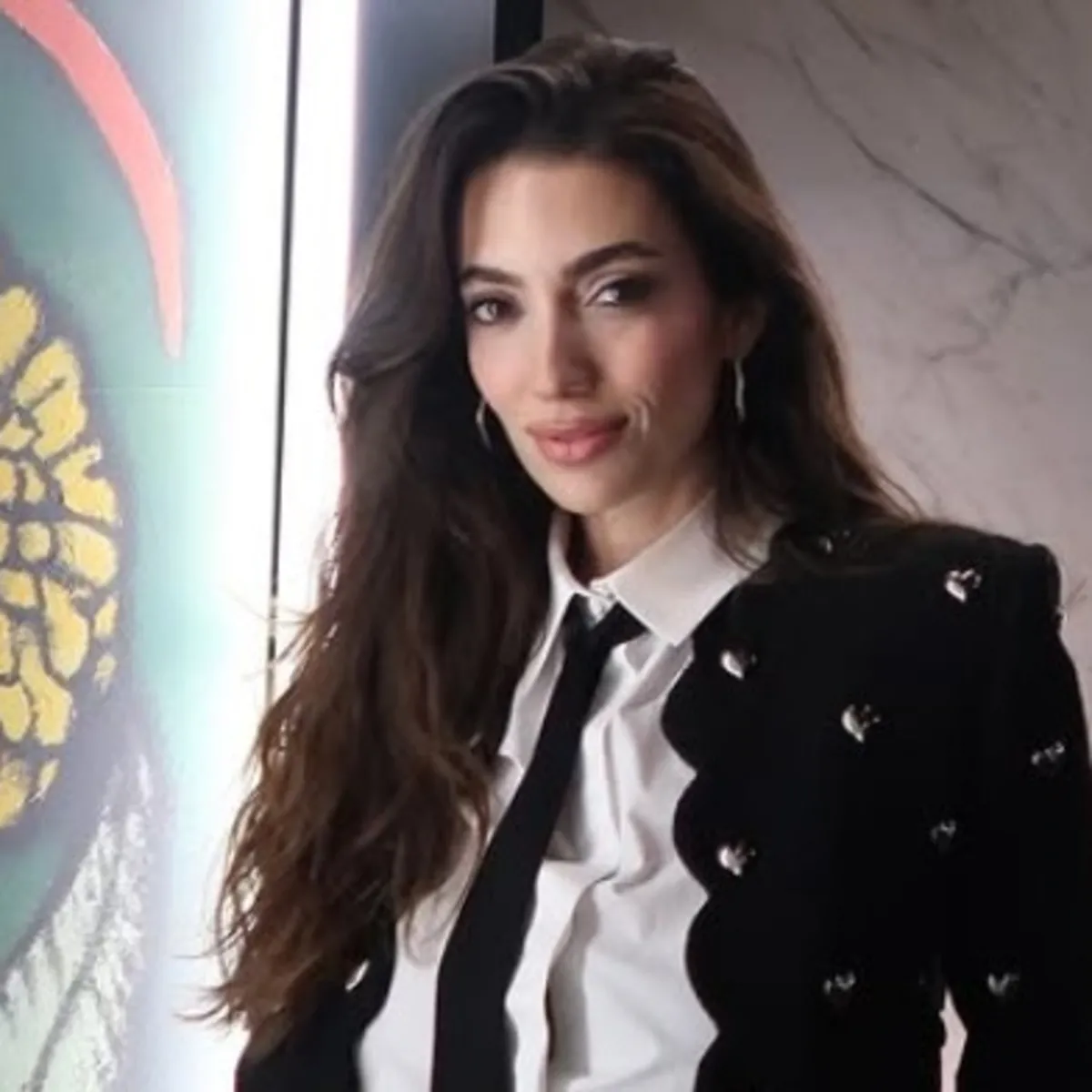 Rachel Araz Kiresepi'nin paylaşımı tepki çekti! Oğlunun geçirdiği kazayı reklama alet etti