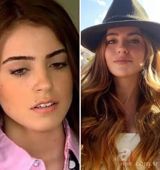 Pınar Dilşeker görenleri şoke etti! Yaptırdığı estetiklerle öyle bir hale geldi ki tanımak imkansız 20