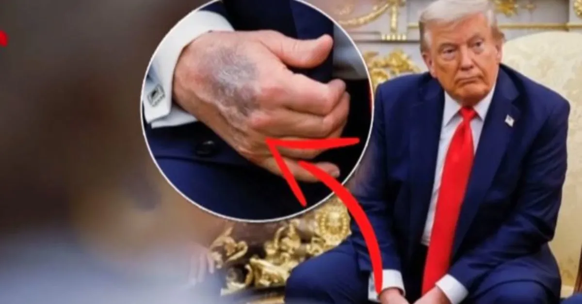 Eli moraran Trump iki gündür neden sessiz?