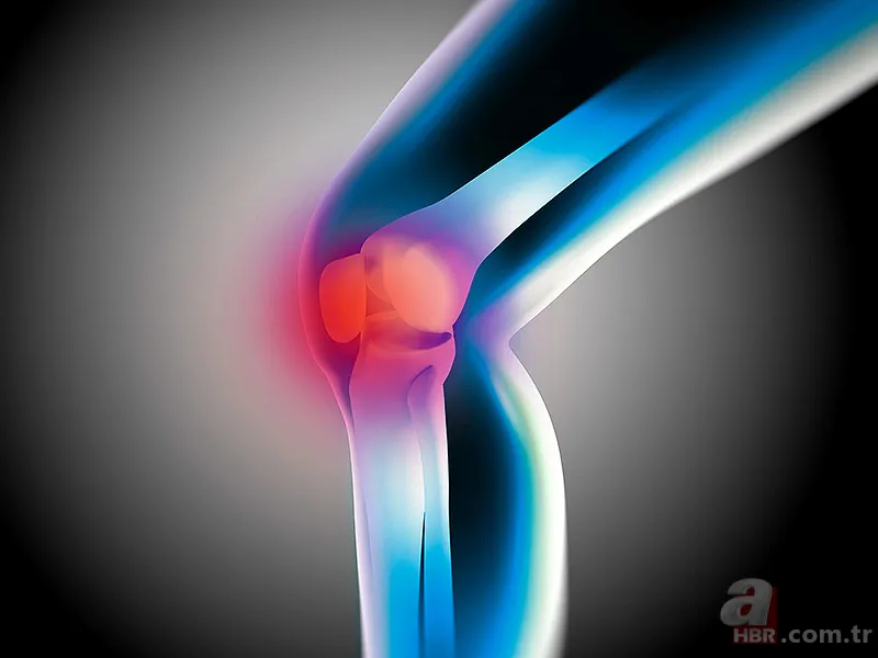 Diz çıkması neden olur? Diz çıkması tedavisi var mı? Diz çıkması belirtileri neler? 14