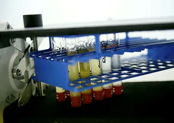 Fransa'dan koronavirüs testi açıklaması