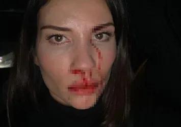 Özer Hurmacı ve Mihriban Hurmacı'nın olaylı davası! İşte hakimin son kararı