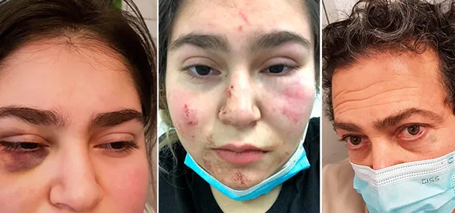 Almanya’da Türk aileye polis şiddeti