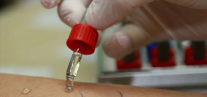 Alerji testinin pozitif çıkması aktif bir alerji olduğunu göstermeyebilir!