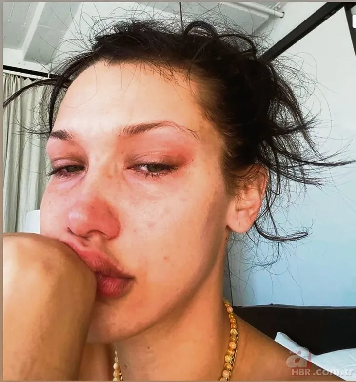 Bella Hadid: Bu kadar acınası olduğum için özür dilerim