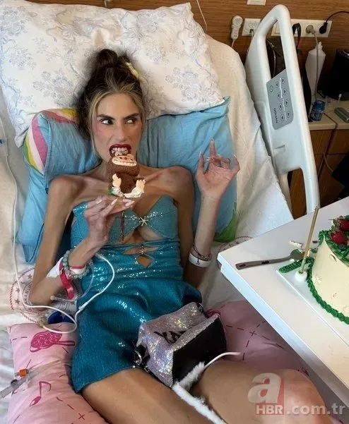 23 kiloya kadar düşen Nihal Candan’dan acı haber! Hayatını kaybetti
